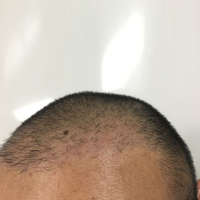 發(fā)際線用戶圖片