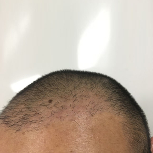 发际线分享社区