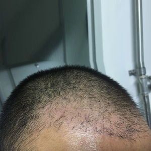发际线分享社区