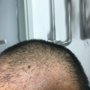 发际线分享社区