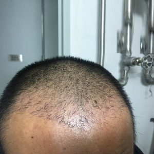 发际线分享社区