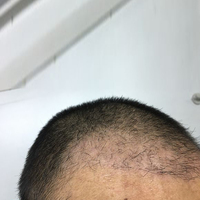 發(fā)際線用戶圖片