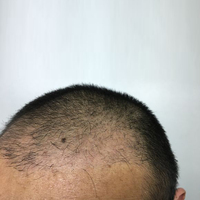 發(fā)際線用戶圖片