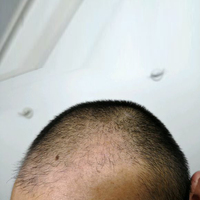 發(fā)際線用戶圖片