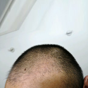 发际线分享社区
