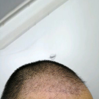 發(fā)際線用戶圖片