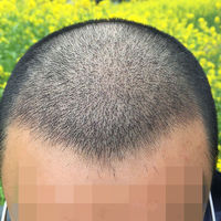 發(fā)際線用戶圖片
