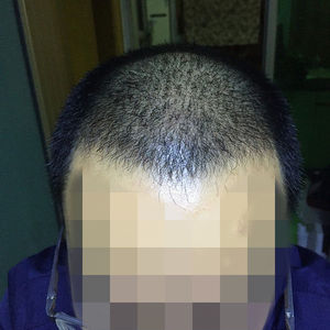 发际线分享社区