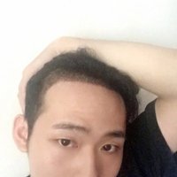發(fā)際線用戶圖片