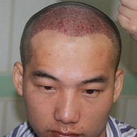 發(fā)際線用戶圖片