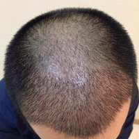 發(fā)際線用戶圖片