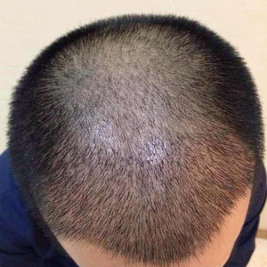 发际线分享社区
