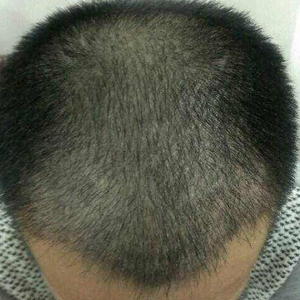 发际线分享社区