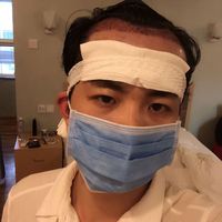發(fā)際線用戶圖片