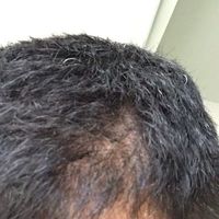 發(fā)際線用戶圖片