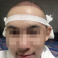 發(fā)際線用戶圖片