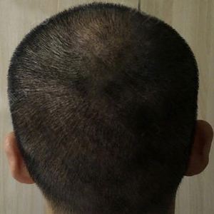 发际线分享社区