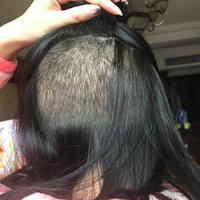 發(fā)際線用戶圖片