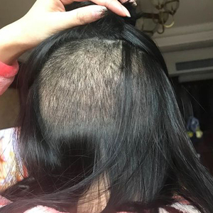 发际线分享社区