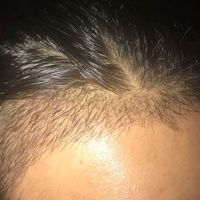 發(fā)際線用戶圖片