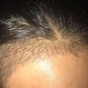发际线分享社区