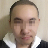 發(fā)際線用戶圖片