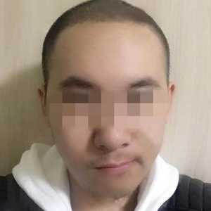 发际线分享社区