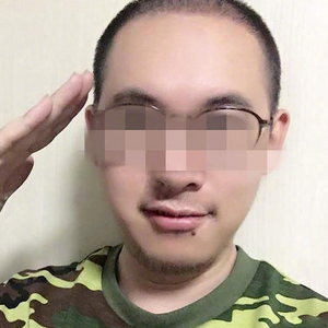 发际线分享社区