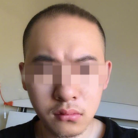 發(fā)際線用戶圖片