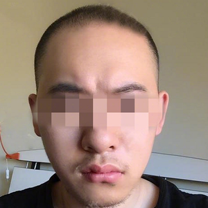 发际线分享社区