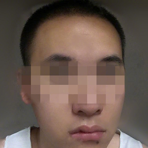 发际线分享社区