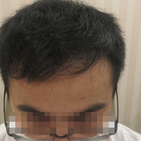 發(fā)際線用戶圖片