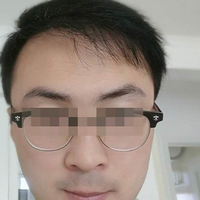 發(fā)際線用戶圖片