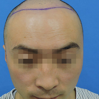 發(fā)際線用戶圖片