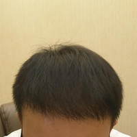 發(fā)際線用戶圖片