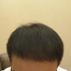 发际线分享社区
