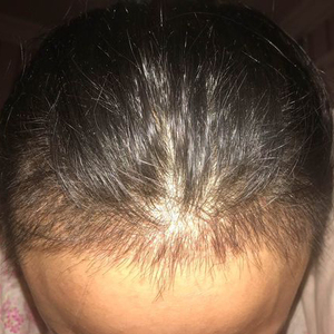发际线分享社区