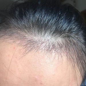 发际线分享社区