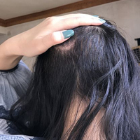 發(fā)際線用戶圖片