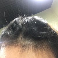 發(fā)際線用戶圖片