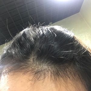发际线分享社区