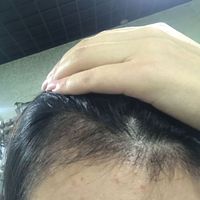 發(fā)際線用戶圖片