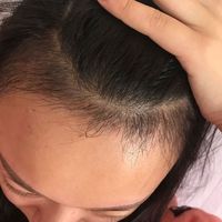 發(fā)際線用戶圖片