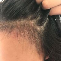 發(fā)際線用戶圖片
