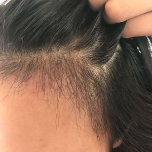 发际线分享社区