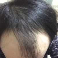 發(fā)際線用戶圖片
