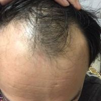 發(fā)際線用戶圖片