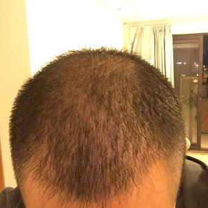 发际线分享社区