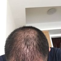 發(fā)際線用戶圖片