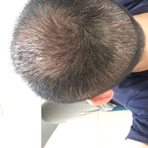 发际线分享社区